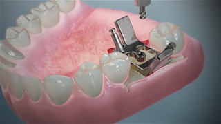 dental animation - jaw