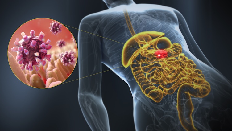 http://www.scientificanimations.com/wp-content/uploads/2014/11/Gastroenteritis-3D-medical-illustration-organ-highlight.jpg