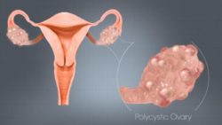 #HerHealthMatters: Reproductive System