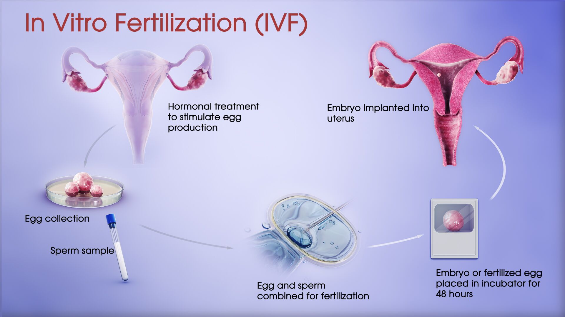 in-vitro-fertilization-ivf