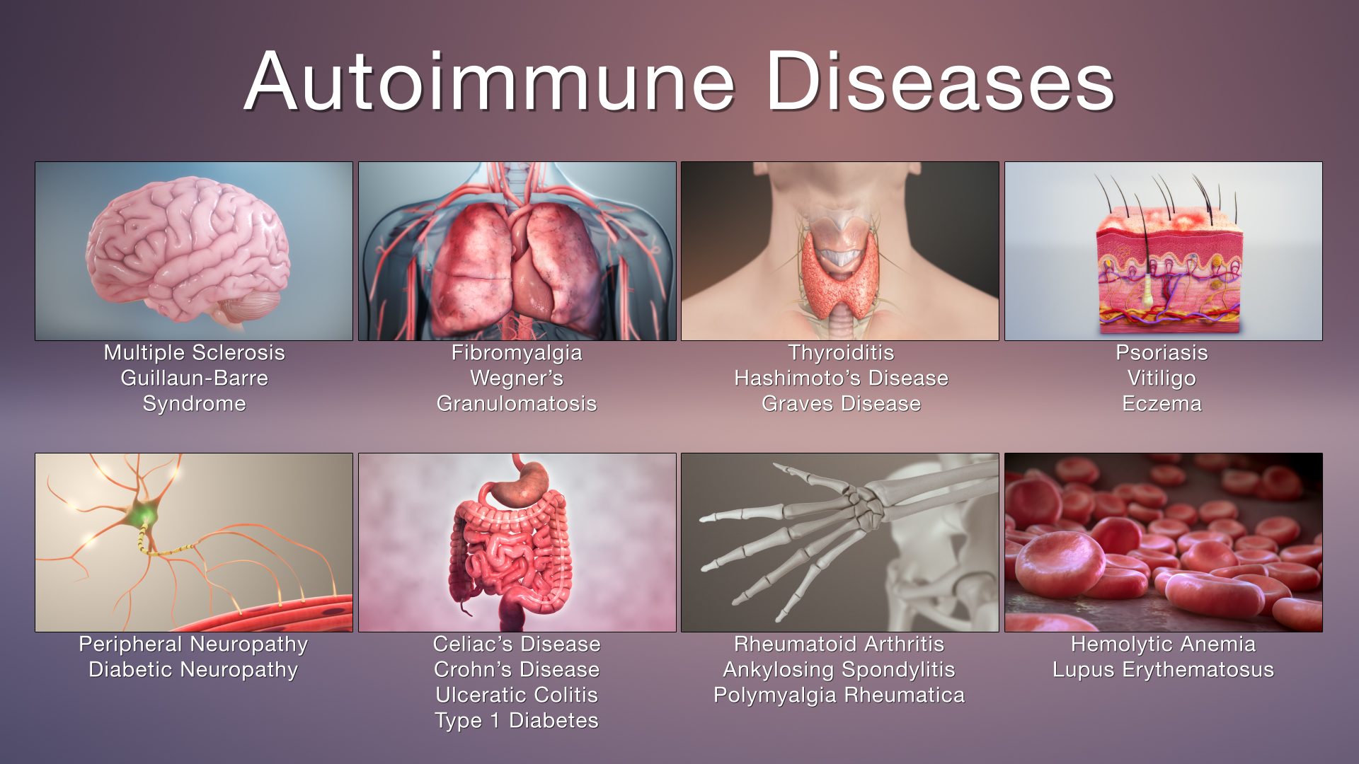 autoimmune disorder symptoms