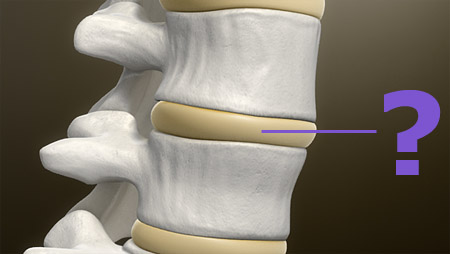 Lumbar Vertebrae