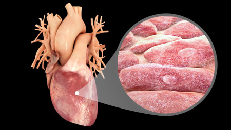 Myocytes