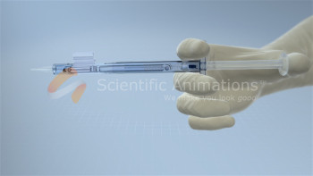 Lens injector - Gallery - Scientific Animations