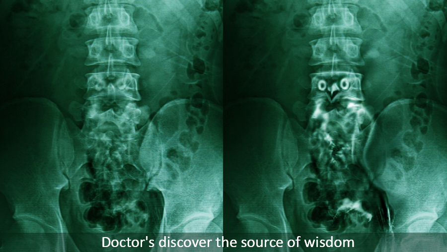 X-ray reveals the source of wisdom