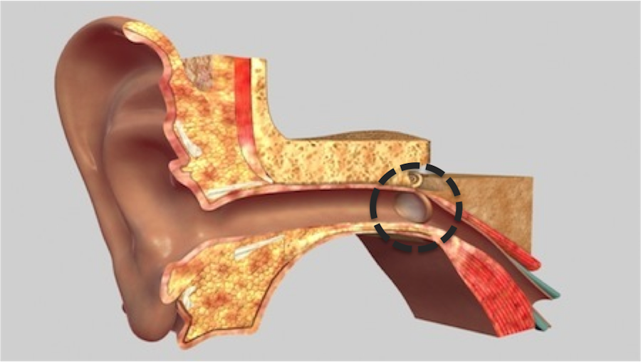 Identify the Structure in the Ear-IQ20