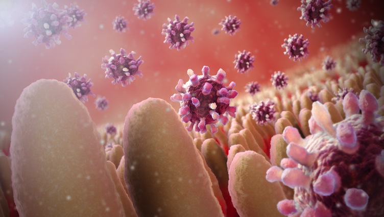 Gastroenteritis 3D medical illustration Norovirus