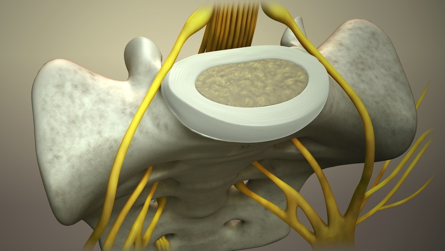 What is the inner core of the vertebral disc called?