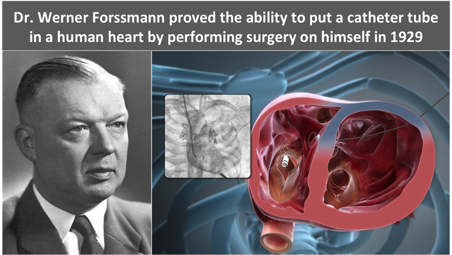 Dr Werner Forssmann-Cardiac Catheterization - Scientific Animations