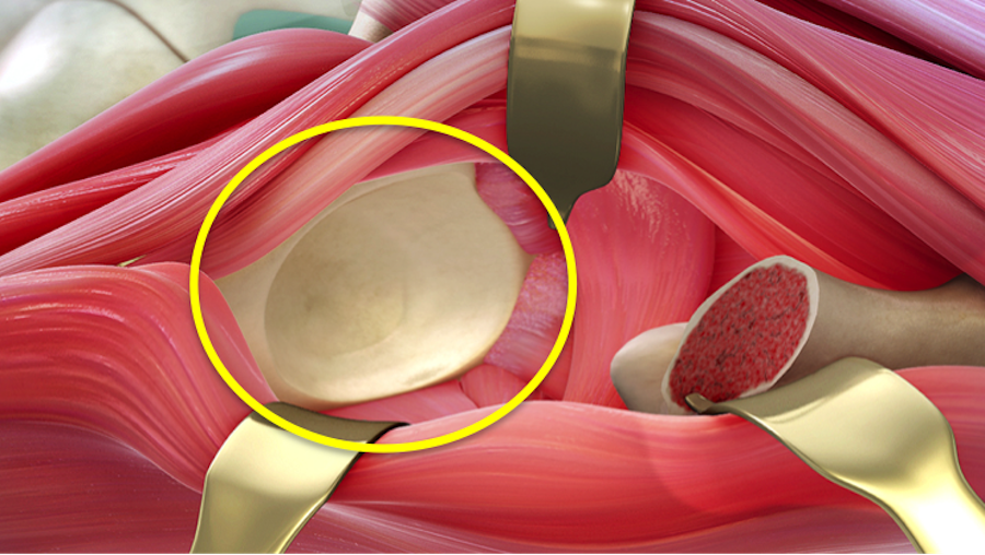 Structure in the pelvic joint