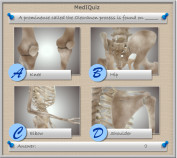 MedIQuiz - Prominence called olecranon is found on?