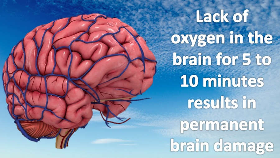 Lack of oxygen in the brain - Scientific Animations