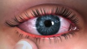 Image Quiz - Which tissue inside the eye controls the amount of light reaching the back of the eye?