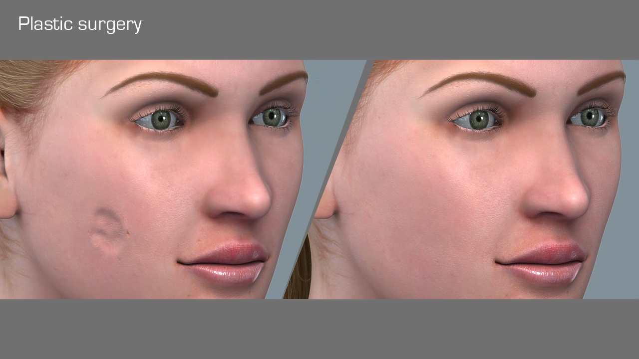 Cosmetic, Plastic and Reconstructive Surgery - Scientific Animations