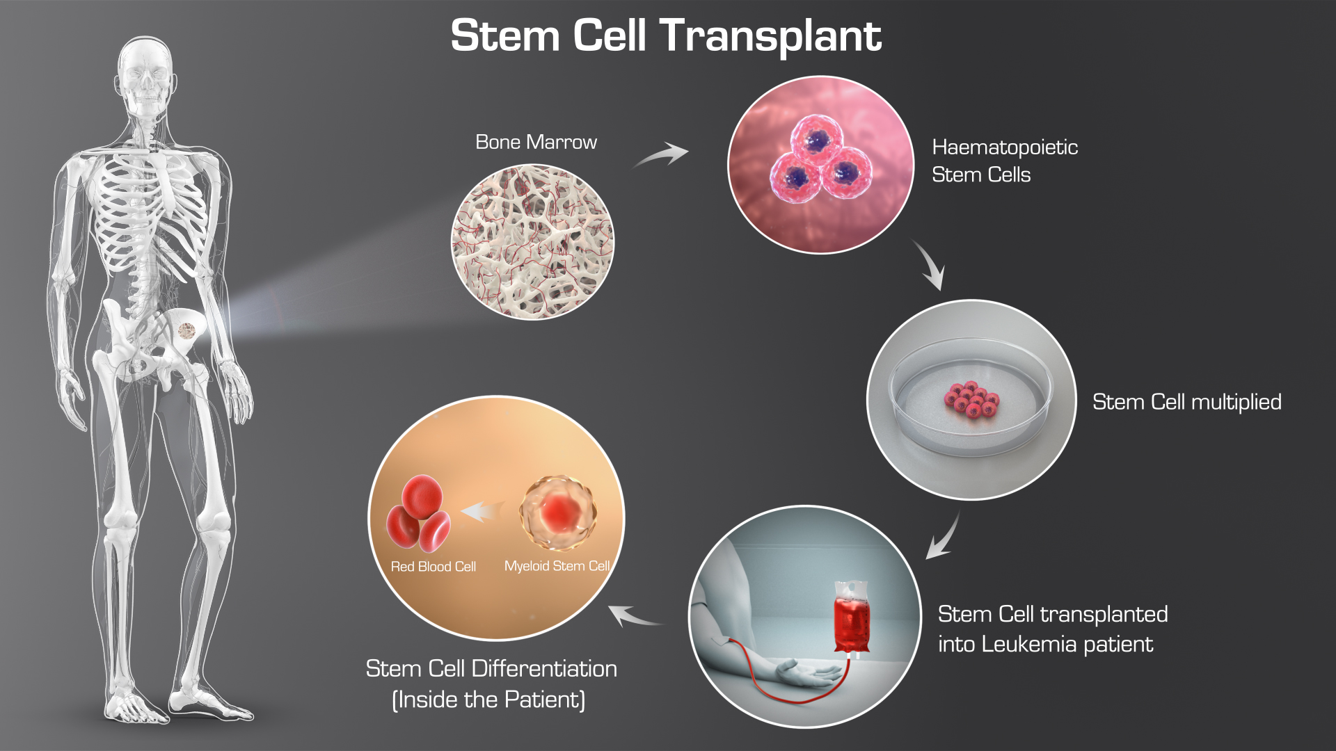 StemCellTransplant - IOW47 - Scientific Animations