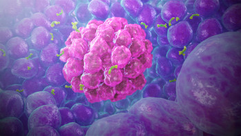 3D Medical Illustration - Cancer Cells - IOW48