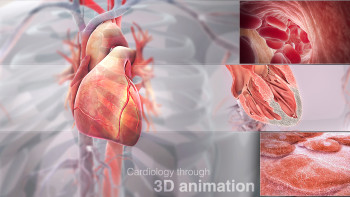 3D Medical Illustration - Cardiology - Heart - IOW47