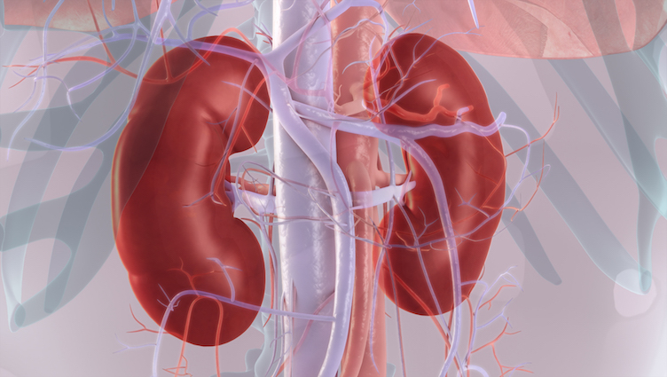 3D Medical Illustration - Chronic Kidney Disease