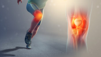 Runner's knee