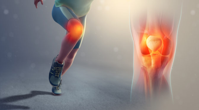 The What, Why And When Of Patellofemoral Pain Syndrome (Runner’s Knee)