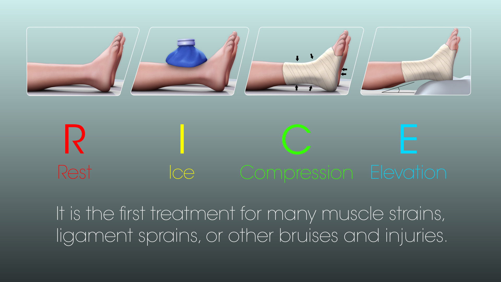 Patellofemoral Pain Syndrome-Runner’s Knee- Scientific Animations