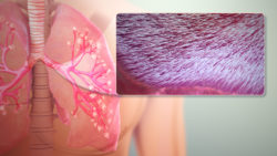3D Medical Animations