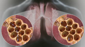 Hyperventilation vs Hyperpnea