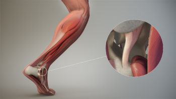 Articular ligament