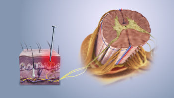 Mechanism of nociceptive pain