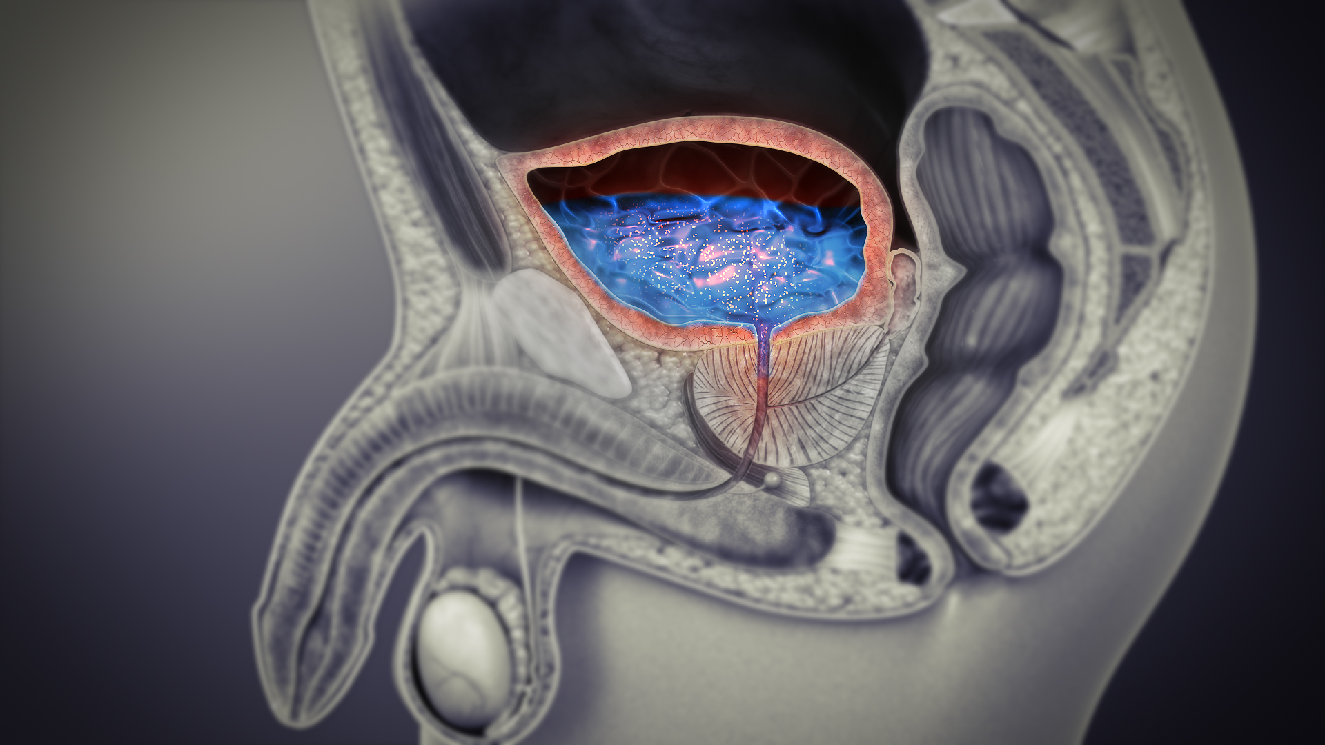 Understanding UTIs in Men: Rare But Complicated