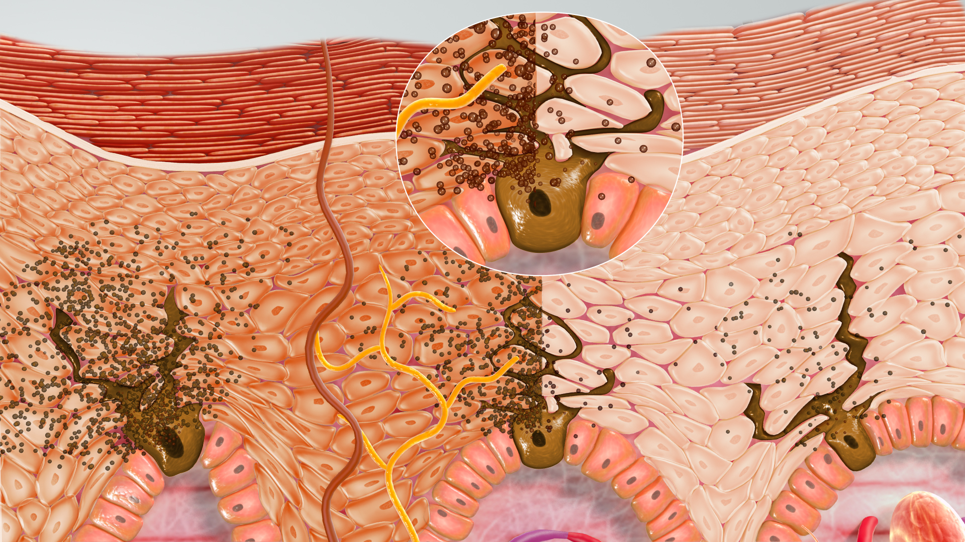 The Chemistry of Skin Tanning