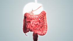 A medical animation still showing Diarrhea