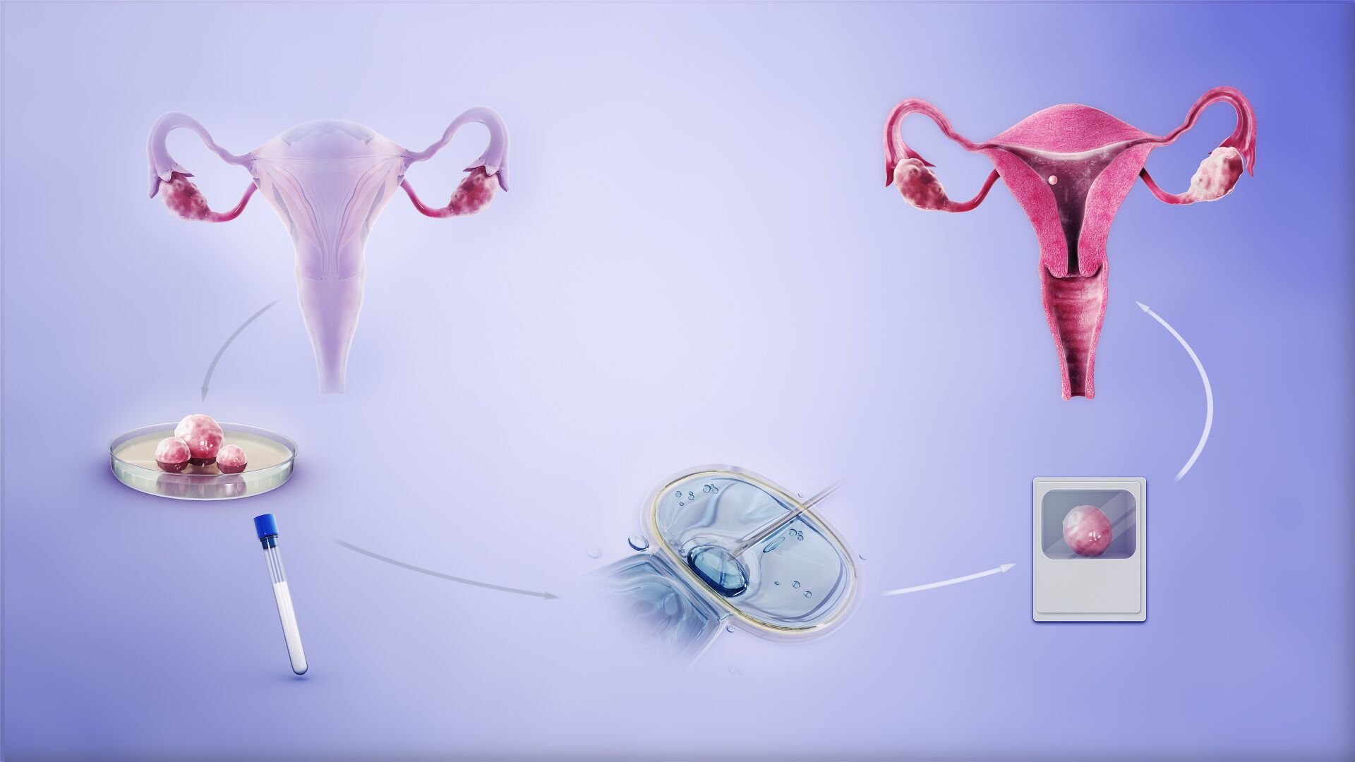 In-Vitro Fertilization (IVF) In-Vitro Fertilization (IVF)