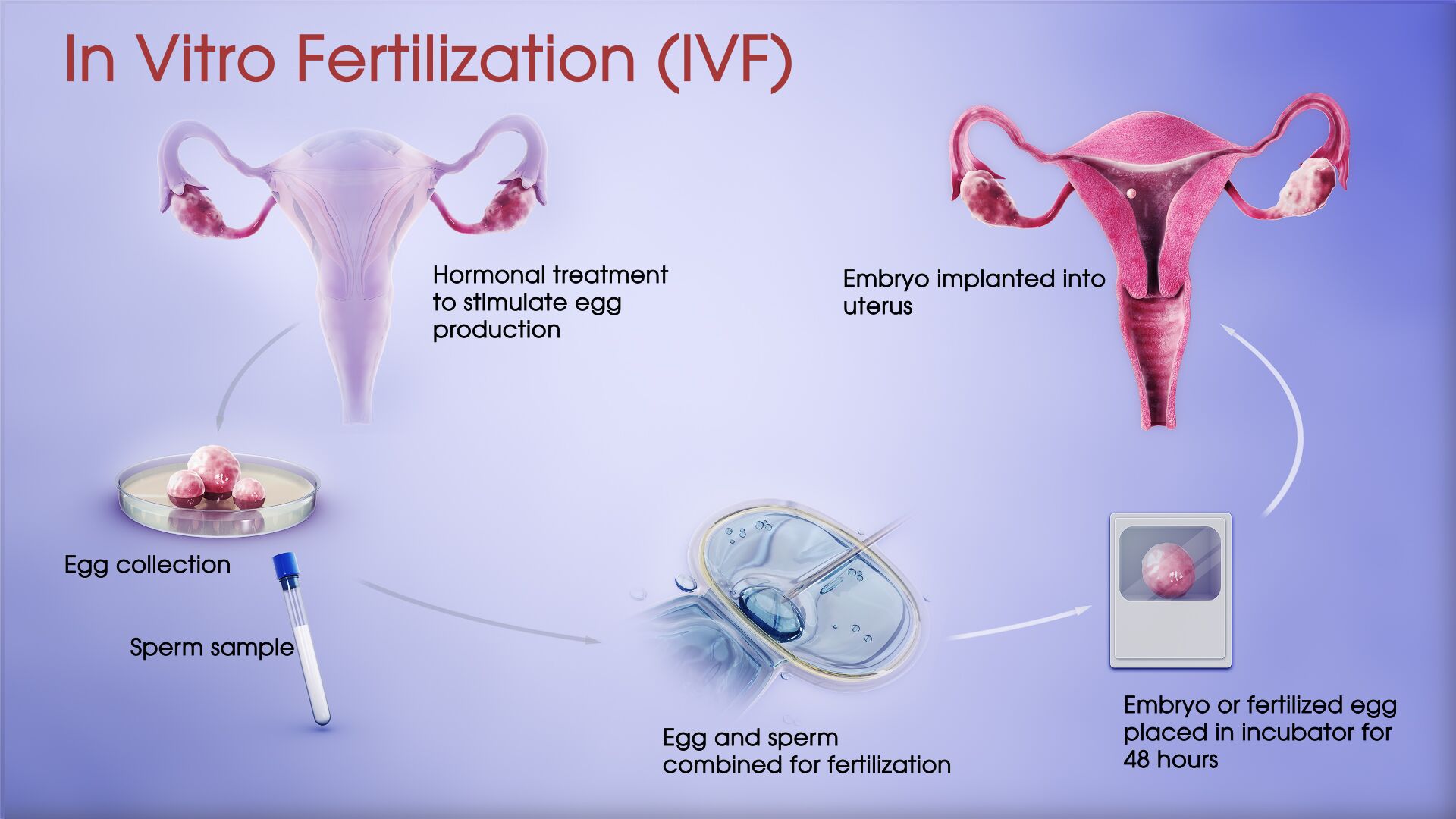 In Vitro Fertilization Ivf