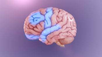 Some parts of an OCD brain showing abnormal activity