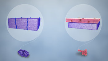 (From L to R) Purple stained Gram-positive and pink stained Gram-negative