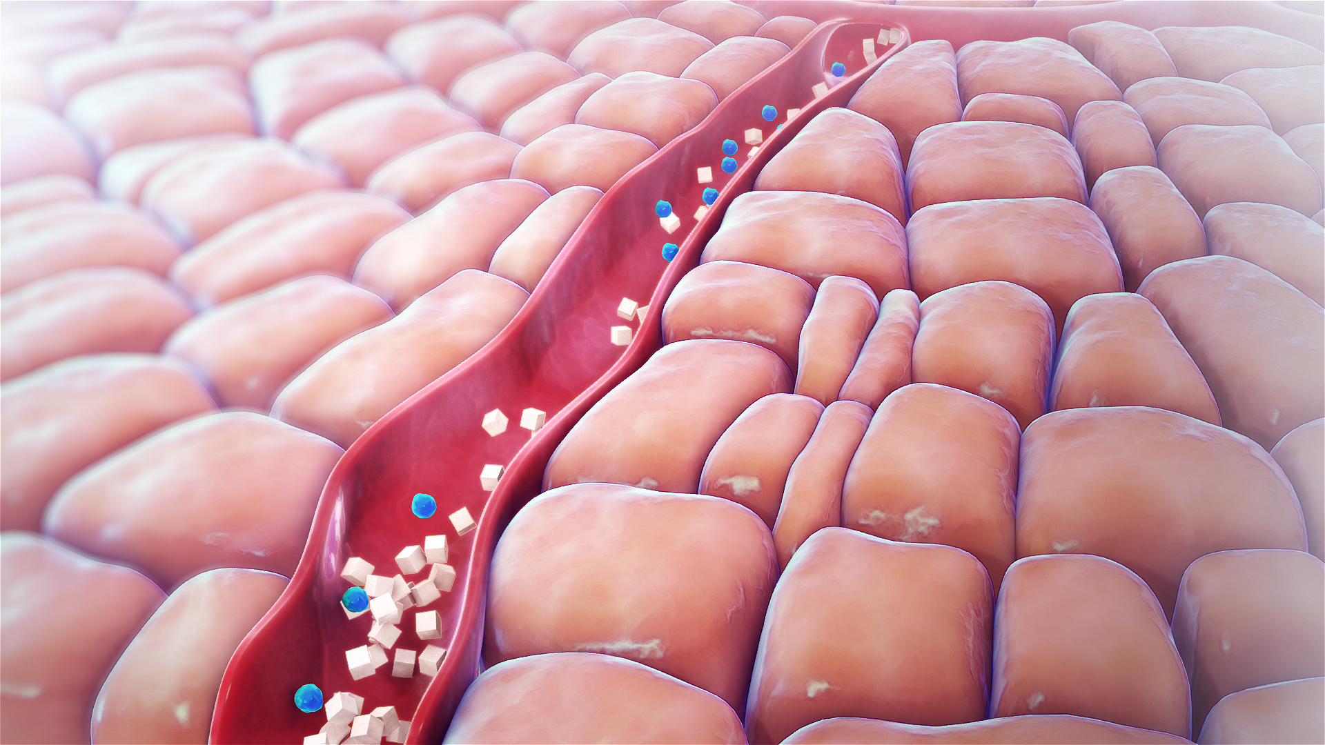 3D Medical Animation still showing Hypoglycemia