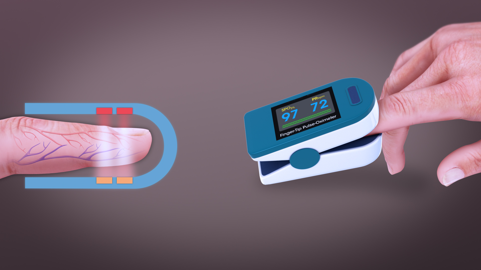 Pulse Oximetry Mechanism, History, Use and Sources of error