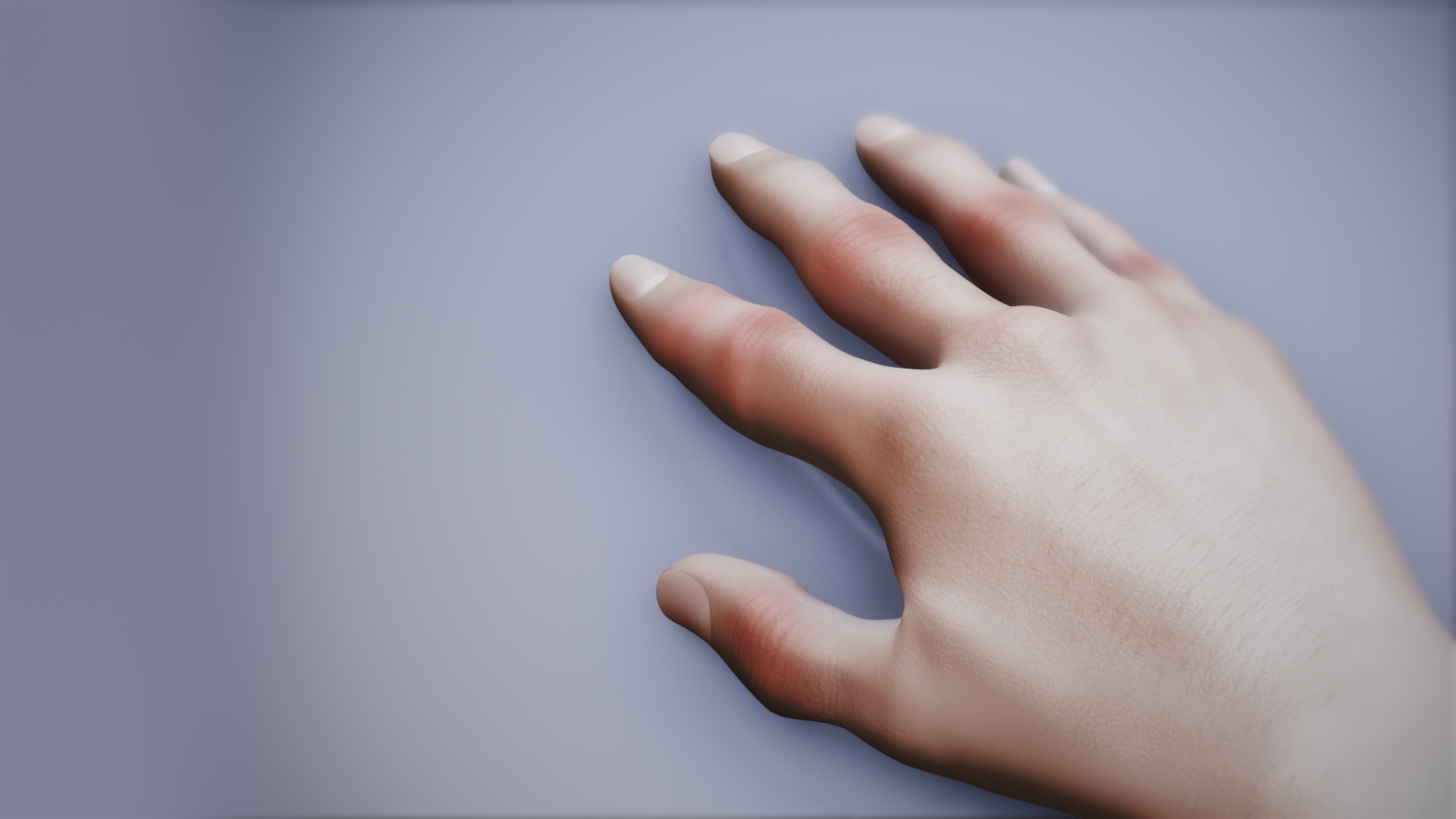 3D Medical Animation still of Gout infected hand.