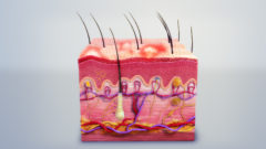 3D Medical Animation still of cross section of inflammatory Skin.