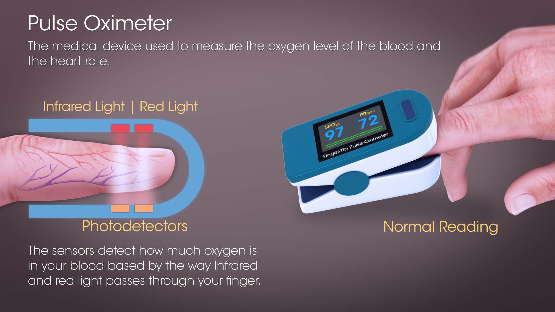 Pulse Oximetry: Mechanism, History, Use and Sources of error