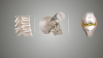 Types of joints based upon their structure (L to R): Cartilaginous joint, Fibrous joint, and Synovial joint