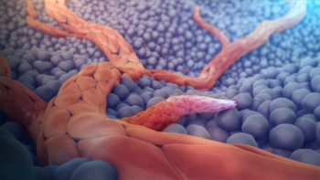 3D medical animation still showing Angiogenesis