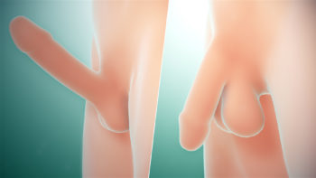 3D medical animation still showing comparison between Erection and Erectile dysfunction or Impotence