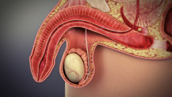 3D medical animation still showing Erectile dysfunction (ED)