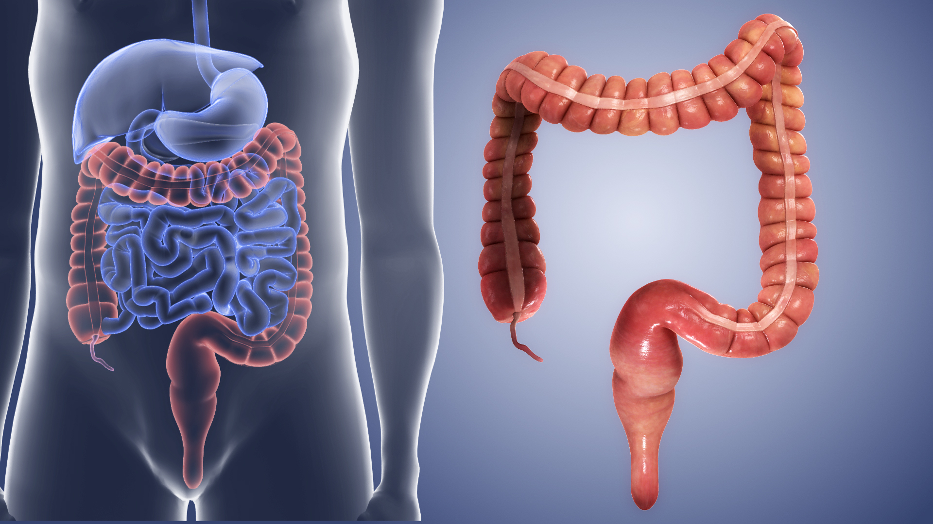 Como mejorar el transito intestinal