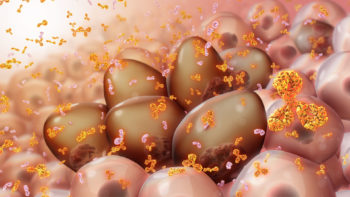 Medical animation still showing Myeloma cells producing monoclonal proteins of varying types