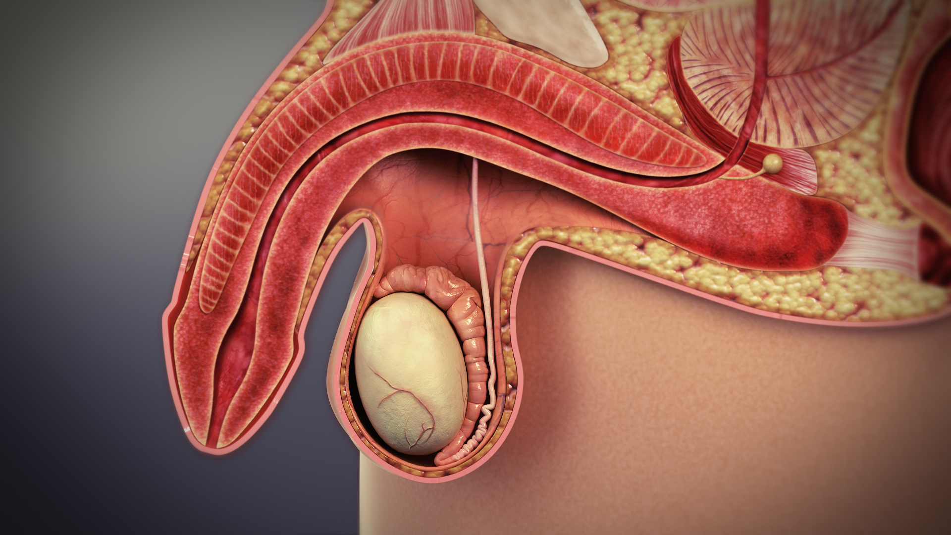 3D medical animation still showing the inability to develop or maintain an erection of the penis during sexual activity.