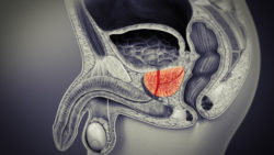 3D medical animation still showing Prostate glands.