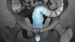 3D medical animation still of Rectum